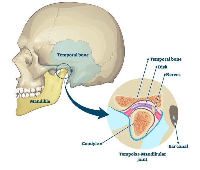 jaw-pain-neck-pain-headaches-mpls-health-wellness-ne